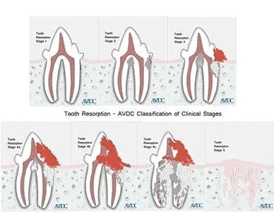 Figure 111